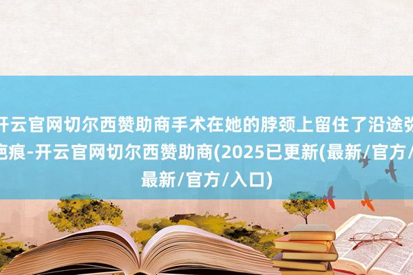 开云官网切尔西赞助商手术在她的脖颈上留住了沿途弥远的疤痕-开云官网切尔西赞助商(2025已更新(最新/官方/入口)